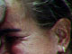Foto 09